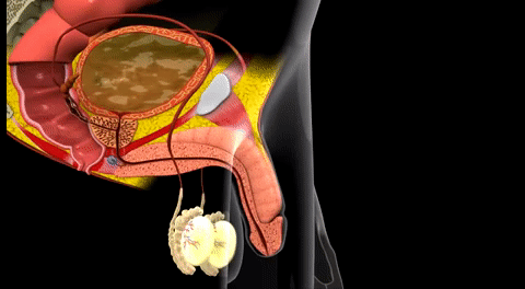 Micro-Vascular Expansion: How Chambers Stretch